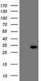 Chromosome 21 Open Reading Frame 62 antibody, CF808847, Origene, Western Blot image 