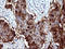 Serpin Family B Member 3 antibody, LS-C338240, Lifespan Biosciences, Immunohistochemistry frozen image 