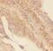 GLI Family Zinc Finger 1 antibody, PB9108, Boster Biological Technology, Immunohistochemistry paraffin image 