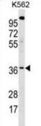 BUD23 RRNA Methyltransferase And Ribosome Maturation Factor antibody, abx031474, Abbexa, Western Blot image 