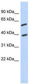 Family With Sequence Similarity 217 Member A antibody, TA330964, Origene, Western Blot image 