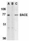 Beta-Secretase 1 antibody, TA306033, Origene, Western Blot image 