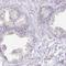 KiSS-1 Metastasis Suppressor antibody, HPA035542, Atlas Antibodies, Immunohistochemistry frozen image 