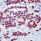 Estrogen Receptor 1 antibody, LS-C88670, Lifespan Biosciences, Immunohistochemistry frozen image 