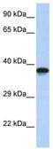 Doublesex- and mab-3-related transcription factor C2 antibody, TA341425, Origene, Western Blot image 