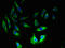 AP2S1 antibody, LS-C211718, Lifespan Biosciences, Immunofluorescence image 