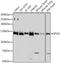 Importin 4 antibody, A11591, Boster Biological Technology, Western Blot image 