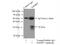 Insulin Like Growth Factor Binding Protein 7 antibody, 19961-1-AP, Proteintech Group, Immunoprecipitation image 