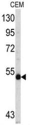MYCN Proto-Oncogene, BHLH Transcription Factor antibody, AP17575PU-N, Origene, Western Blot image 