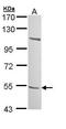 Beta 3-Glucosyltransferase antibody, GTX109849, GeneTex, Western Blot image 