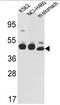 KRT18 antibody, AP17266PU-N, Origene, Western Blot image 