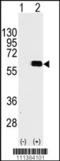 PKB beta antibody, TA302205, Origene, Western Blot image 