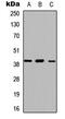 Abhydrolase Domain Containing 13 antibody, GTX54900, GeneTex, Western Blot image 