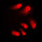 CREB Binding Protein antibody, GTX56255, GeneTex, Immunofluorescence image 
