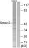 SMAD2 antibody, LS-C199579, Lifespan Biosciences, Western Blot image 