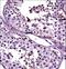 Cancer/Testis Antigen 2 antibody, LS-C167115, Lifespan Biosciences, Immunohistochemistry frozen image 