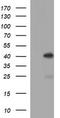 Serpin Family B Member 3 antibody, LS-C788346, Lifespan Biosciences, Western Blot image 
