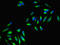 DnaJ Heat Shock Protein Family (Hsp40) Member C6 antibody, orb23610, Biorbyt, Immunocytochemistry image 