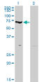 Erythrocyte Membrane Protein Band 4.2 antibody, LS-C197140, Lifespan Biosciences, Western Blot image 