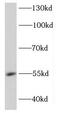 DEAD-Box Helicase 49 antibody, FNab02311, FineTest, Western Blot image 