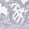 MYCBP Associated Protein antibody, HPA023257, Atlas Antibodies, Immunohistochemistry frozen image 