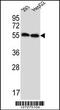 Endogenous Retrovirus Group 3 Member 1, Envelope antibody, 57-042, ProSci, Western Blot image 