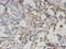 Glutaminyl-Peptide Cyclotransferase antibody, LS-C134053, Lifespan Biosciences, Immunohistochemistry paraffin image 