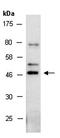 C-C Motif Chemokine Receptor 3 antibody, orb67196, Biorbyt, Western Blot image 