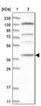 Chromosome 21 Open Reading Frame 58 antibody, PA5-57157, Invitrogen Antibodies, Western Blot image 
