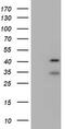 Ubiquitin carboxyl-terminal hydrolase 12 antibody, M08214, Boster Biological Technology, Western Blot image 