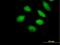 Zinc Finger Protein 280A antibody, H00129025-B01P, Novus Biologicals, Immunocytochemistry image 