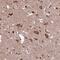 HYLS1 Centriolar And Ciliogenesis Associated antibody, NBP1-83513, Novus Biologicals, Immunohistochemistry paraffin image 