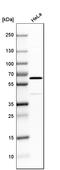Polypeptide N-Acetylgalactosaminyltransferase 2 antibody, HPA011222, Atlas Antibodies, Western Blot image 