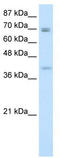 Homeobox protein DLX-3 antibody, TA330203, Origene, Western Blot image 