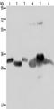 Hydroxymethylglutaryl-CoA lyase, mitochondrial antibody, TA350049, Origene, Western Blot image 