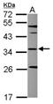 Sterol Carrier Protein 2 antibody, NBP2-20511, Novus Biologicals, Western Blot image 