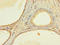 Zinc Finger Protein 432 antibody, orb357751, Biorbyt, Immunohistochemistry paraffin image 