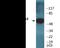 Checkpoint Kinase 2 antibody, EKC2194, Boster Biological Technology, Western Blot image 