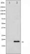 Synuclein antibody, abx010380, Abbexa, Western Blot image 