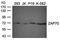 Zeta Chain Of T Cell Receptor Associated Protein Kinase 70 antibody, orb76561, Biorbyt, Western Blot image 