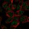 ATP Binding Cassette Subfamily G Member 5 antibody, HPA016514, Atlas Antibodies, Immunofluorescence image 
