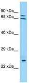 Keratin 74 antibody, TA331333, Origene, Western Blot image 
