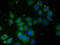 60 kDa SS-A/Ro ribonucleoprotein antibody, A52457-100, Epigentek, Immunofluorescence image 