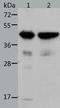 Actin, alpha skeletal muscle antibody, TA323242, Origene, Western Blot image 