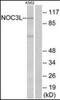 NOC3 Like DNA Replication Regulator antibody, orb178962, Biorbyt, Western Blot image 