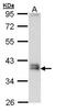 Gamma-Glutamyl Hydrolase antibody, PA5-28941, Invitrogen Antibodies, Western Blot image 