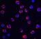 Short transient receptor potential channel 6 antibody, NBP1-77261, Novus Biologicals, Immunofluorescence image 