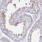 RAB11 Family Interacting Protein 4 antibody, HPA021595, Atlas Antibodies, Immunohistochemistry paraffin image 