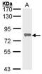 Alkaline Phosphatase, Biomineralization Associated antibody, TA308847, Origene, Western Blot image 