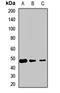Eukaryotic Translation Termination Factor 1 antibody, LS-C667789, Lifespan Biosciences, Western Blot image 